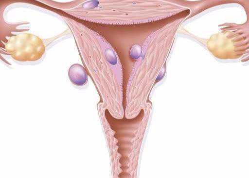 绝经子宫内膜变厚了怎么办？