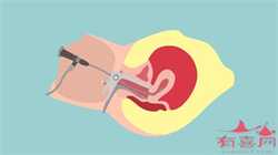成都代生可靠吗，武汉黄浦医院做试管口碑怎样 试管婴儿对女性有伤害吗